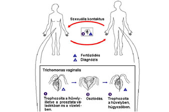 A trichomoniasis vaginális terjedése
