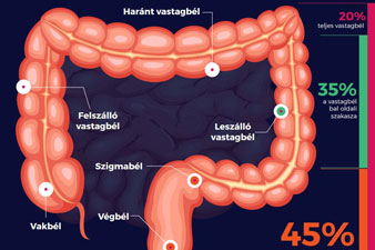 végbélrepedés diétája 8 kg fogyás