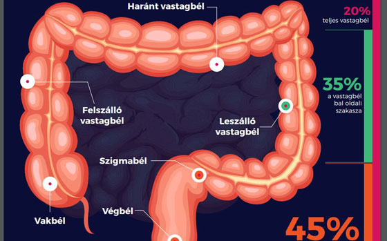 fogyni fekélyes vastagbélgyulladás esetén)