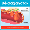 A vastagbéldaganat és a végbélrák (infografika)