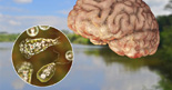 Naegleria fowleri