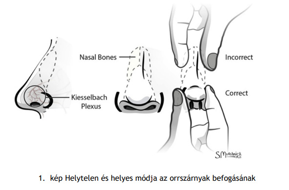 Helytelen és helyes módja az orrszárnyak befogásának