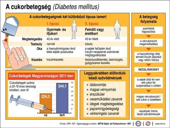 Cukorbetegség - infografika Cukorbetegség - infografika