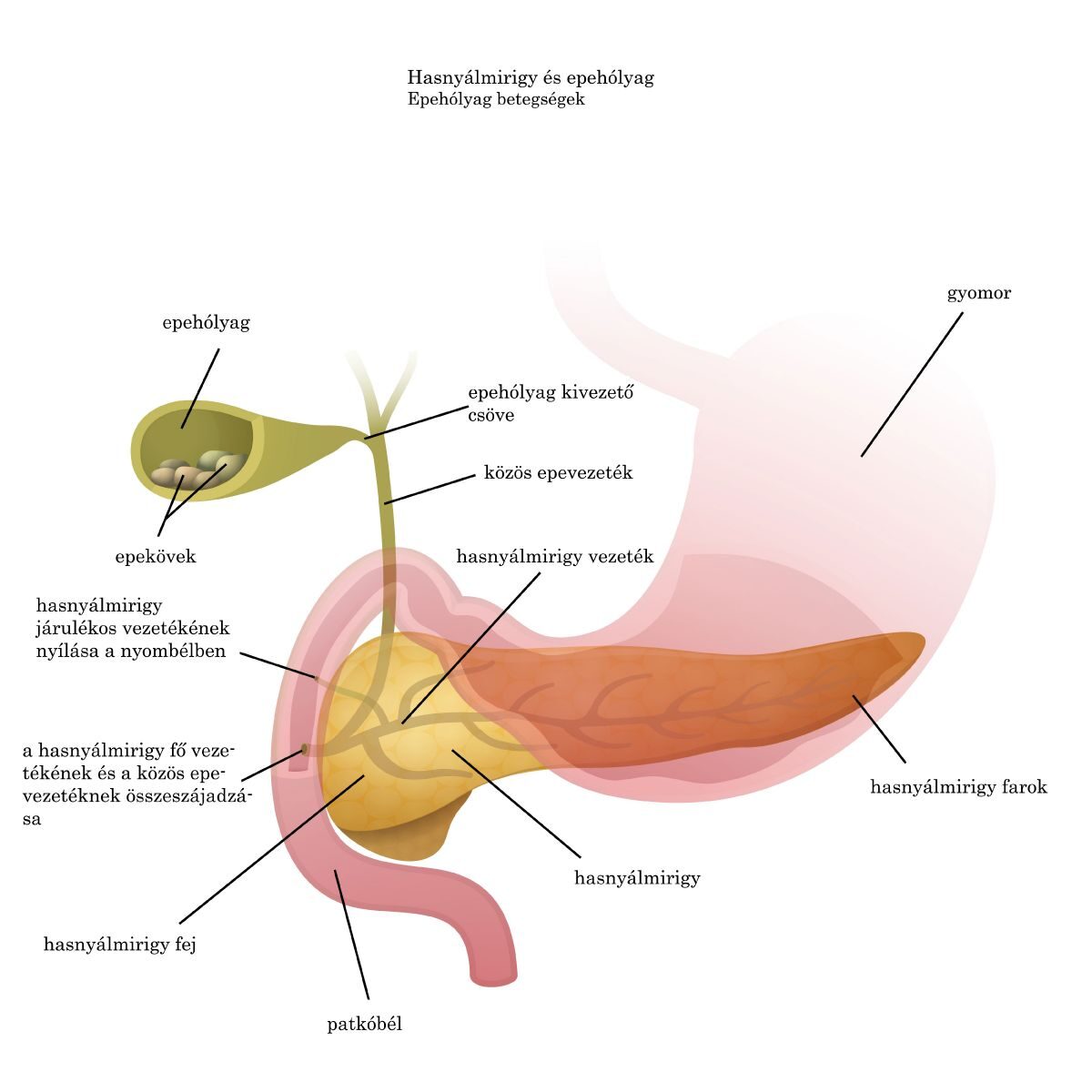 Giardia és helminták tünetei, Giardia-fertőzés (giardiasis)
