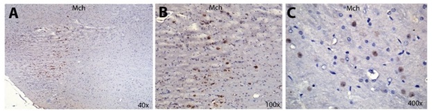 Formalin fixált paraffin