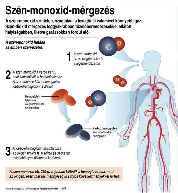 Szén-monoxid-mérgezés