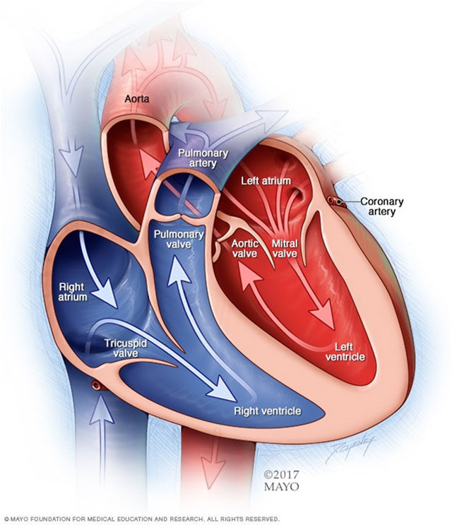 fogyás és aorta stenosis