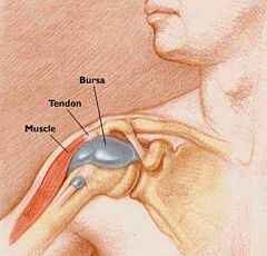 csípőízület coxarthrosis 1 fokos kezelése