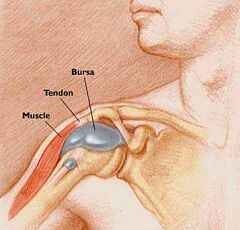 könyökízületi bursitis kezelés