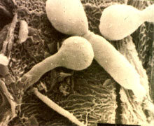 Candida albicans gomba