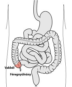 Vakbélgyulladás tünetei