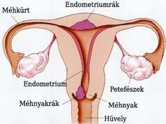 Hogyan lesz a rákmegelőző állapotokból méhnyakrák? | antaresilang.hu