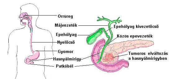 hogyan öl a rák