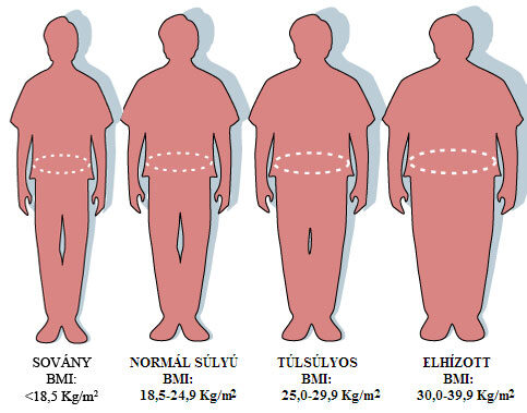 Túlsúly: Nem csak a BMI számít