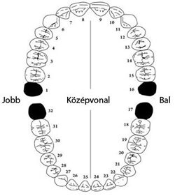 Fogsor és a bölcsességfogak helyzete