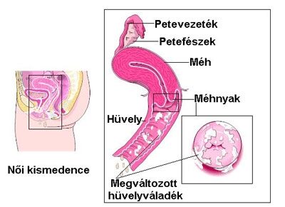 nemi úton terjedő betegségek paraziták)