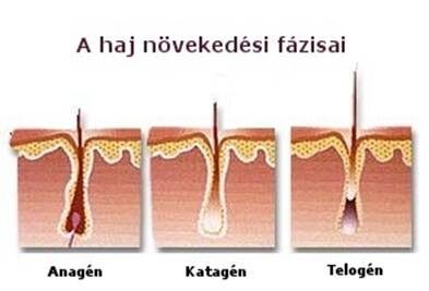 hajhagymák