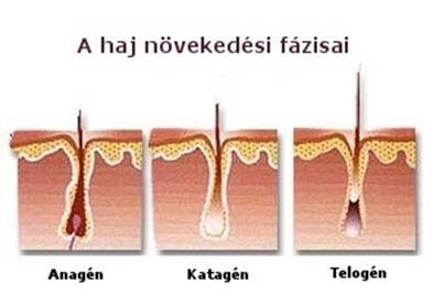 hajhagymák