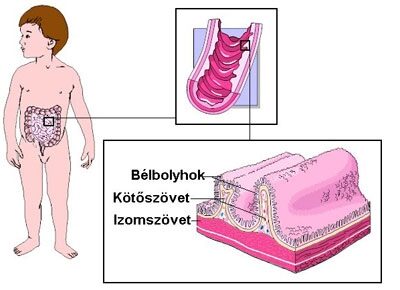 éjszakai hasfájás okai)