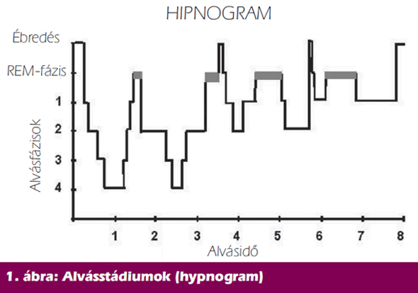 Alvásstádiumok (hypnogram)