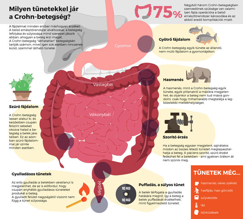 KATTINTSON A KÉPRE! - Crohn-betegség infografika
