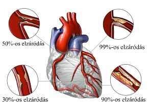 kardio szív egészségügyi termék