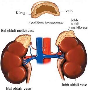 mellékvese adenoma