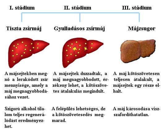 Májnagyobbodás tünetei