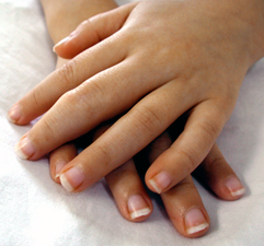 Kevert kötőszöveti betegségben (MCTD) az ujjak megduzzadhatnak; Kép forrása: z.about.com
