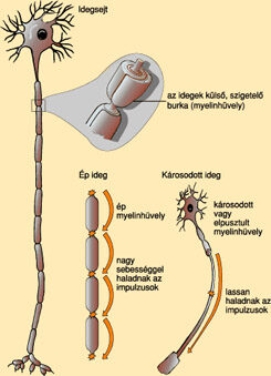 A sclerosis multiplex patomechanizmusa