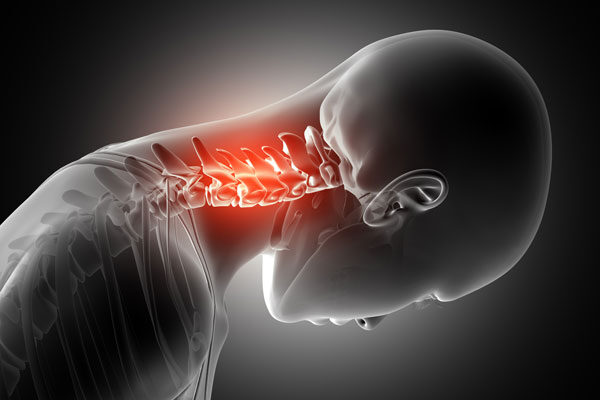 hogyan kell kezelni a nyaki gerincet