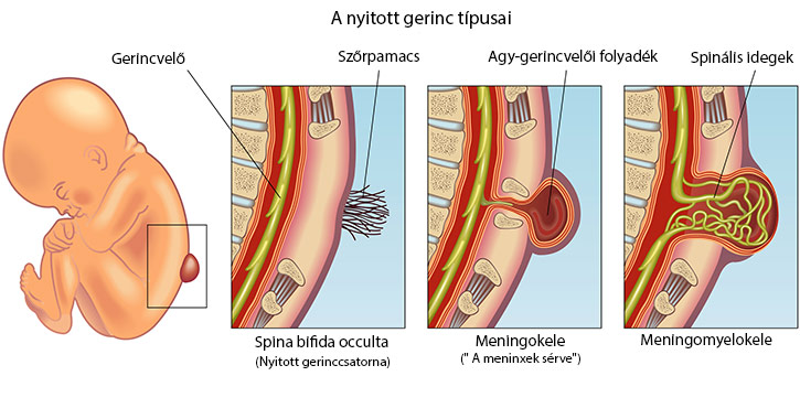 Nyitott gerinc ábra