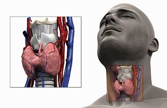 mellékpajzsmirigy adenoma műtét