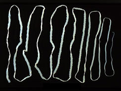 galandféreg címke a bal oldal fáj a férgektől
