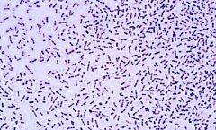A pneumococcus baktérium mikroszkópos képe