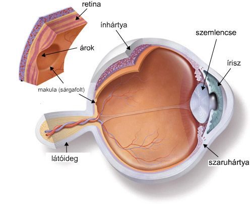 myopia 6 dioptria olyan