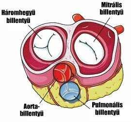 szívbillentyű meszesedés)