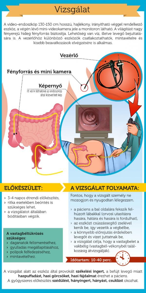 Diéta után gasztroszkópia és kolonoszkópia