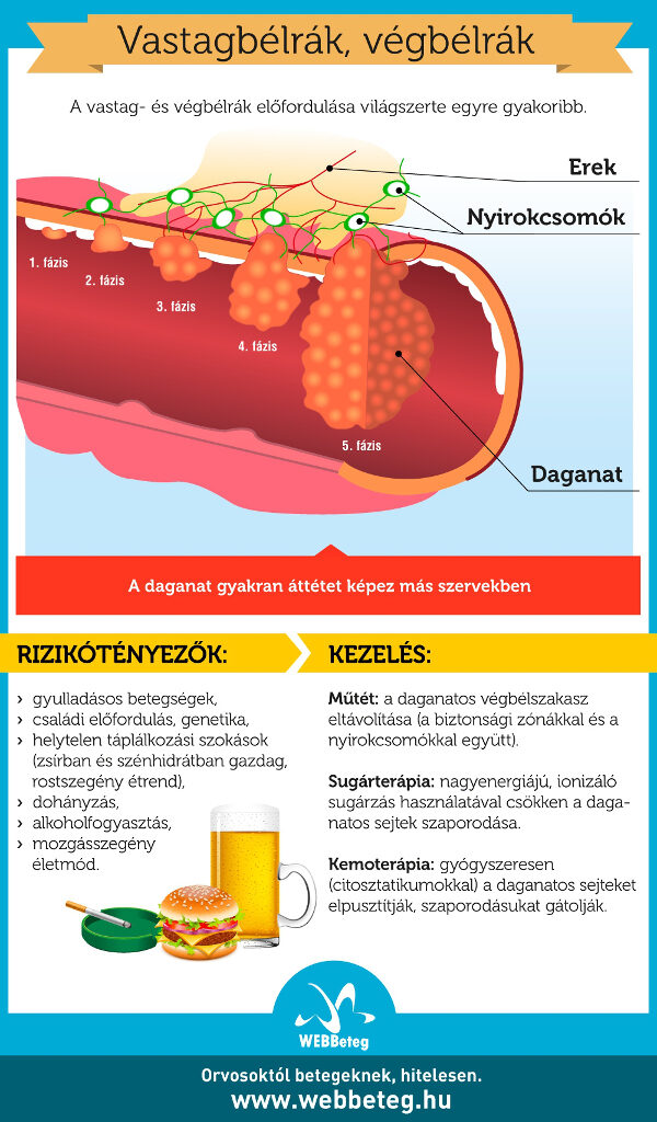 vastagbélrák