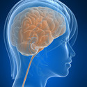 Stroke (Agyvérzés és agyi érelzáródás)