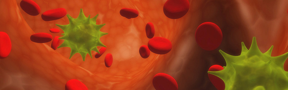 Leukémia – A vérképzőrendszer malignus betegségei