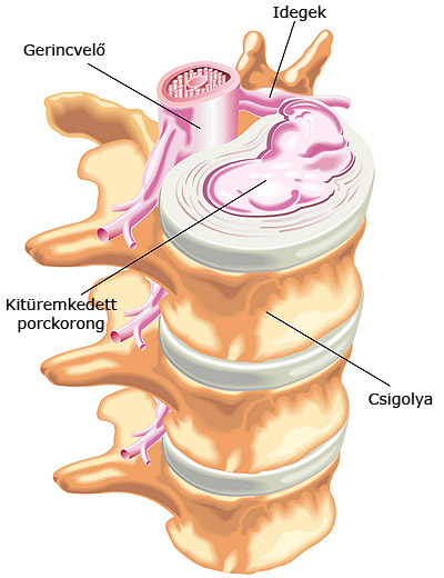 Gerinc, idegek és porckorong anatómia