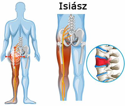Isiász ábra