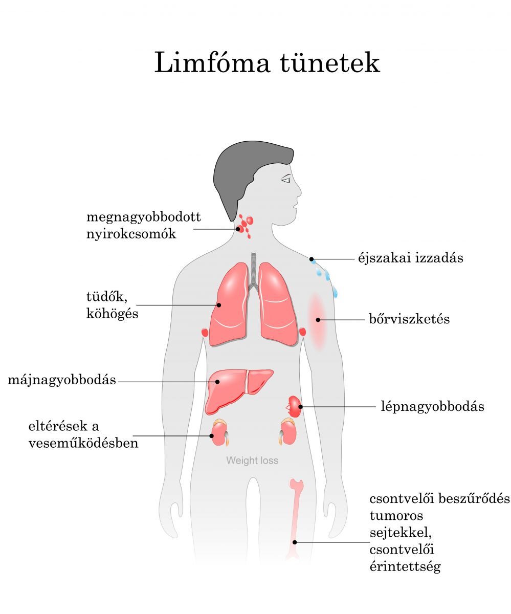 Tünetek a nő testében, A vastag paraziták