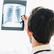 Tüdőrák röntgen