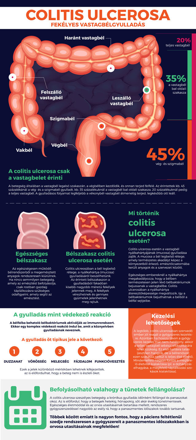 A colitis (vastagbélgyulladás) diétás kezelése