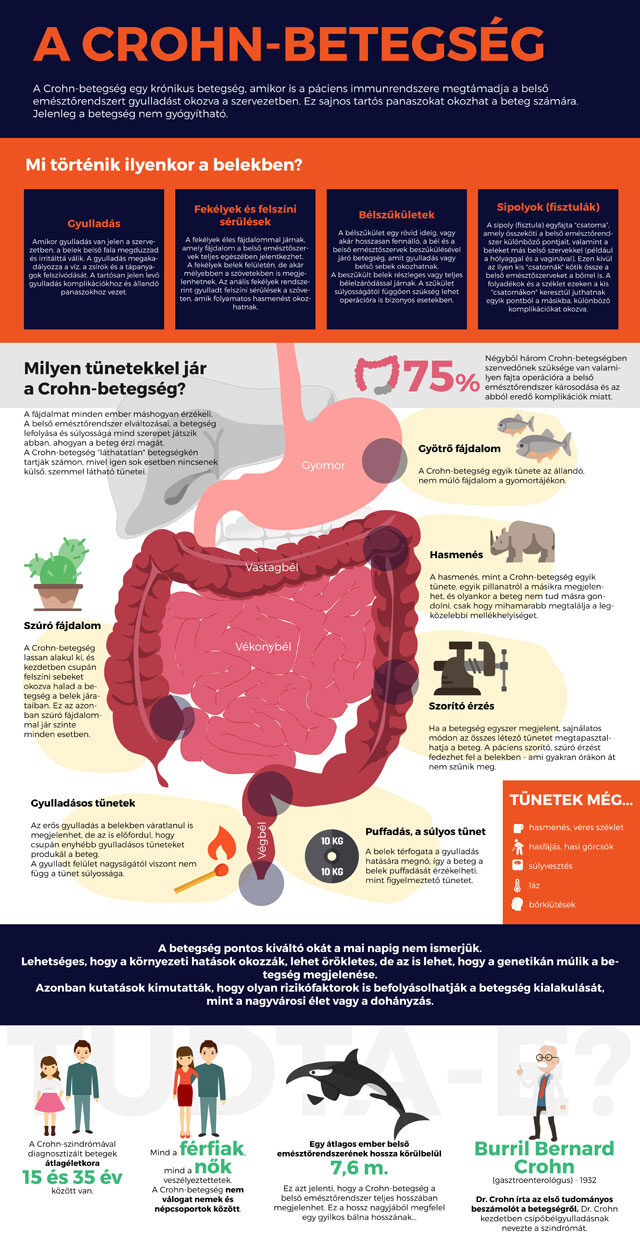 Crohn-betegség infografika