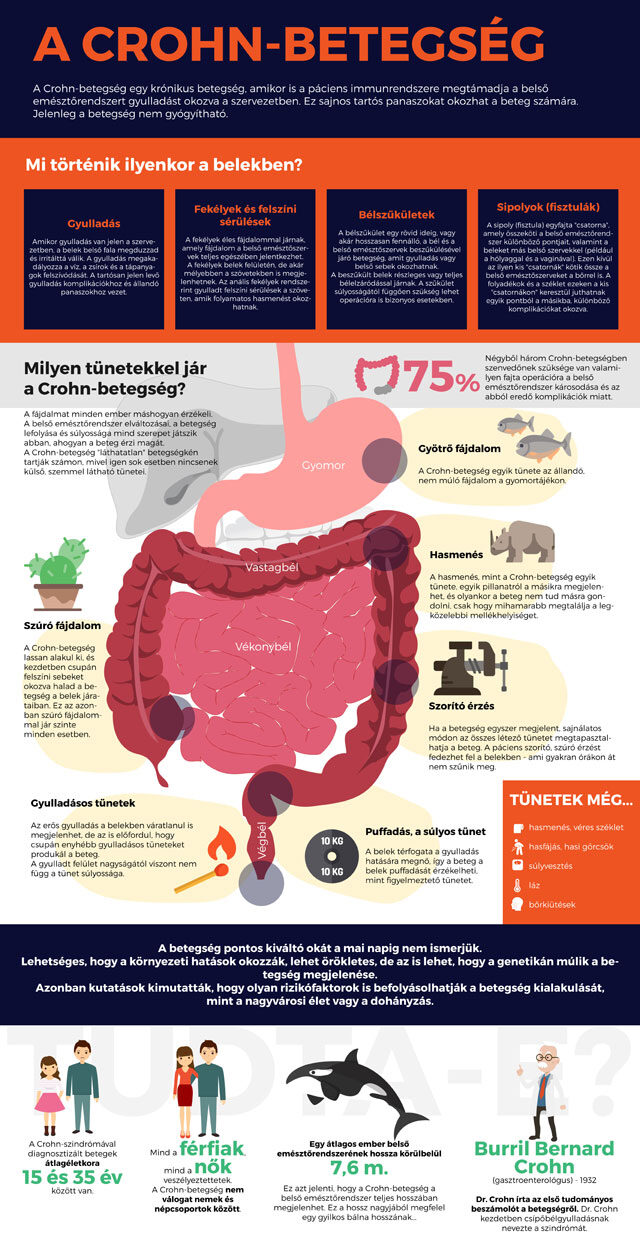 Crohn-betegség tünetei és kezelése