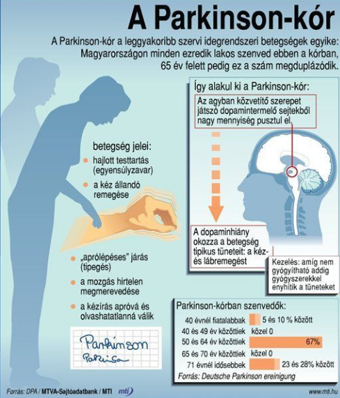 Parkinson-kór infografika