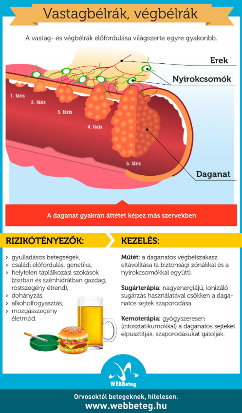 A vastagbélrák